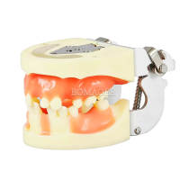 M2003 Yellow Full Arch Dental Implant Practice Typodont Model