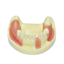 Yellow Mandibular Dental Implant Practice Model