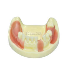 Yellow Mandibular Dental Implant Practice Model