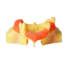 M2012 Maxillary Sinus Lateral Wall Windowing Practice Model