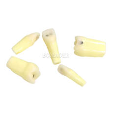 Caries Practice Teeth Model M8024-1 with Caries Lesions, Mixed Assortment, 10 Pcs