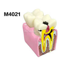 Dental problem demonstration model M4021