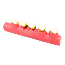 Periodontal problem classification model m4010