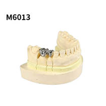 Full crown casting production steps model m6013