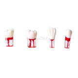 Endodontic practice model m8006 (total code)